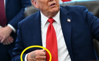 Main image related to The Trump chronic venous insufficiency diagnosis was announced in