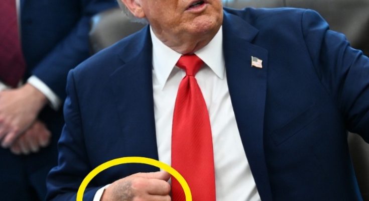 Main image related to The Trump chronic venous insufficiency diagnosis was announced in